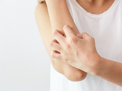 掻いた傷のあともキレイに。諦めない美肌への道